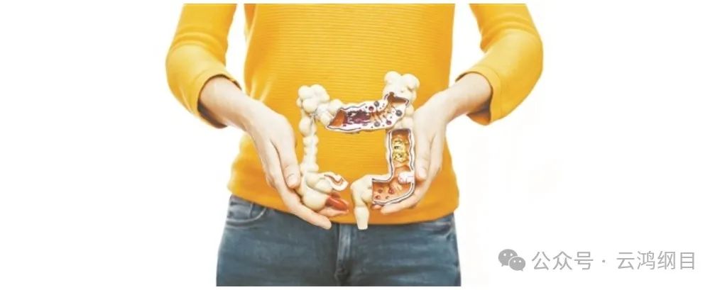 【單細胞轉(zhuǎn)錄組測序】先天性巨結腸發(fā)病機制揭示